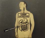 Surgical Film and the Problem of Anatomical Legibility